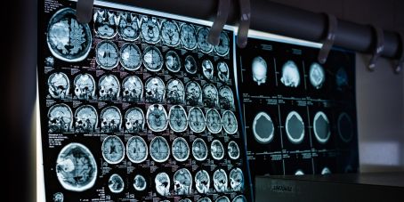Medizintechnik-Aktien: Innovation hat Bestand, während Bewertungen zurückgesetzt werden (Foto: Kiril Ukr auf Pixabay)